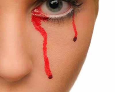 Кървави сълзи: от това заболяване страда всяка десета жена